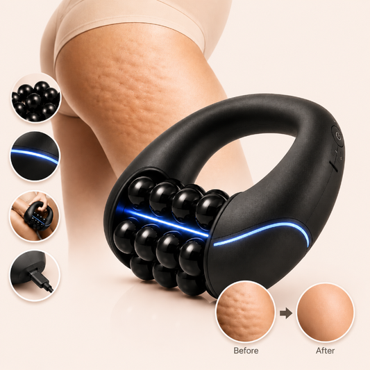 SenseRoll™ Electric 360° Massage Roller — 1