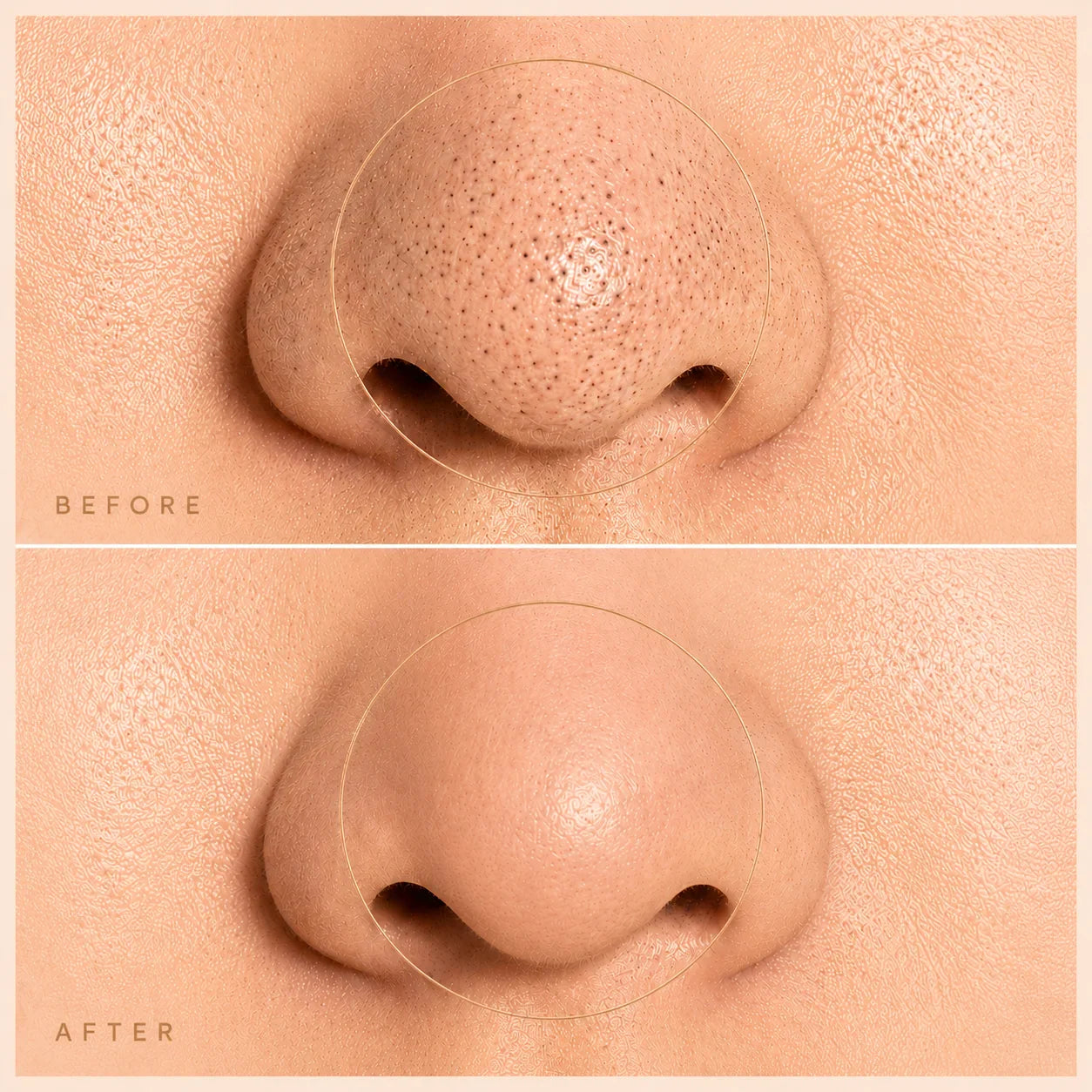 PoreClear™ Facial Extractor Pro — 2